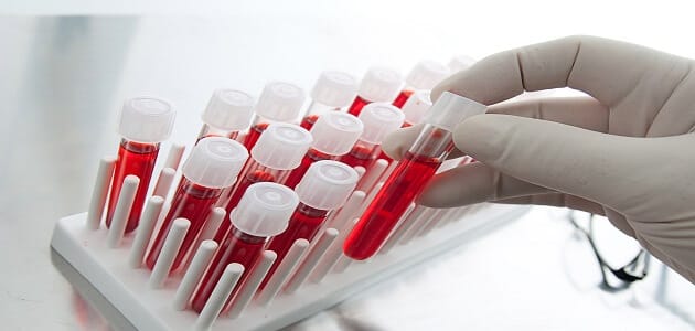 كيفية عمل رجيم فصيلة الدم بالتفصيل