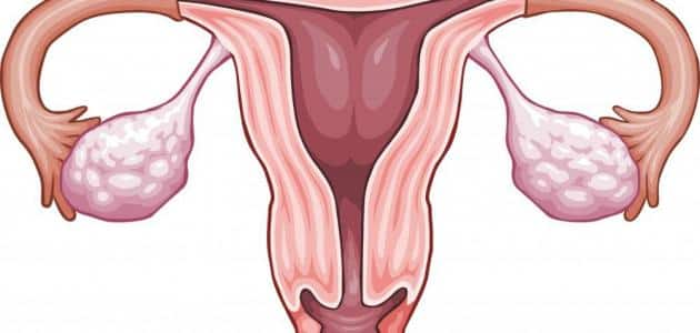 هل الرحم ذو القرنين يمنع الحمل