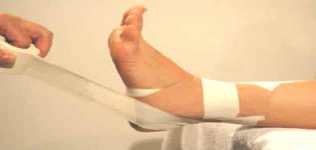 ٣اسباب أساسية لتورم القدم بعدالجبس وكيفية علاجها