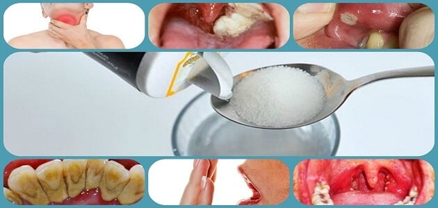 أهمية نظافة الأسنان واللثة عند المضمضة بالماء والملح