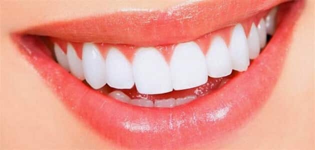 أنواع الوجوه الخزفية للأسنان