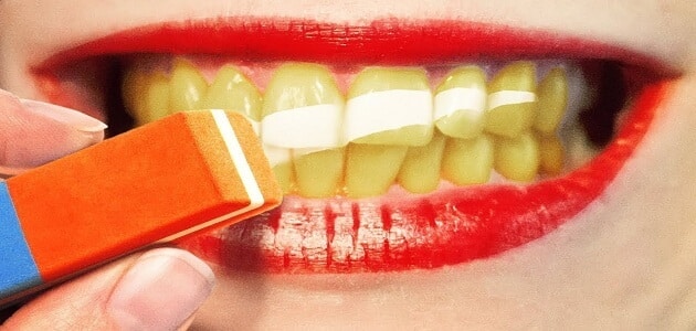 اكثر طريقة فعالة لتبييض الاسنان