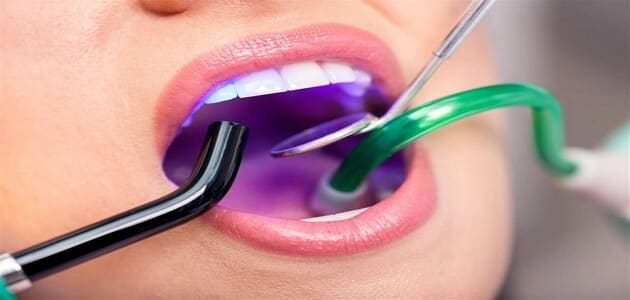 كيفية تقويم الأسنان بالليزر
