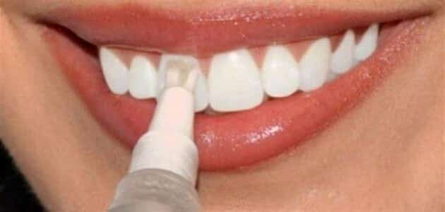 ما هي أضرار برد أو نخر الأسنان