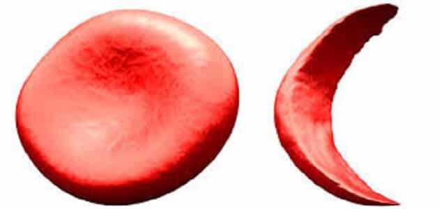 ما هو خضاب الدم الطبيعي