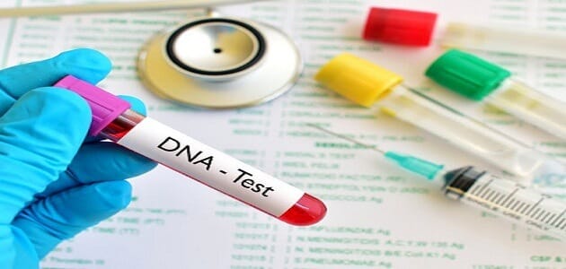 ما هو شروط تحليل DNA