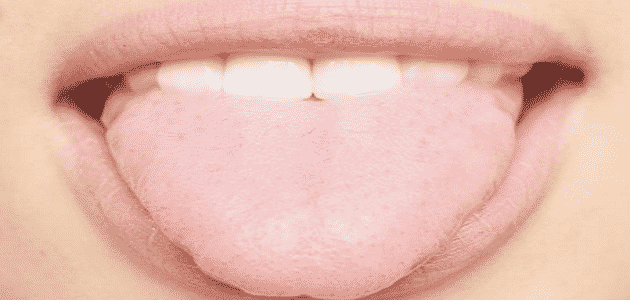 علاج قلة اللعاب في الفم