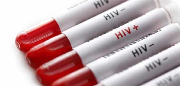 كيفية الكشف عن مرض الإيدز