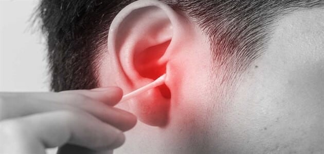 أسباب حكة الأذن وعلاجها