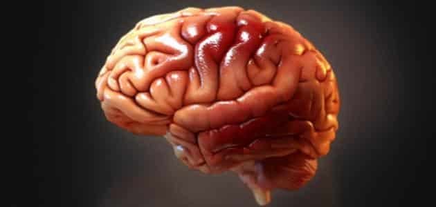 مرض تاكل خلايا المخ اسبابه وعلاجه