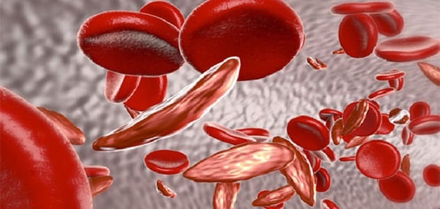 أسباب تلوث الدم في الجسم