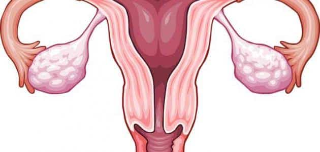 أعراض بطانة الرحم المهاجرة والحمل