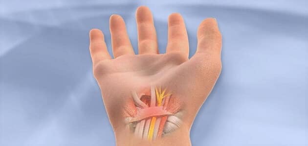 اعراض قطع الوتر في الإصبع