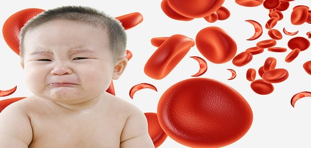 ما هي أمراض الدم الوراثية