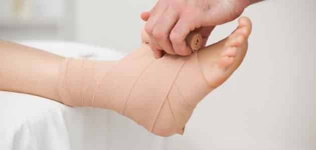 طريقة علاج تمزق اربطة القدم
