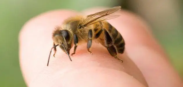 علاج حساسية لسعات النحل