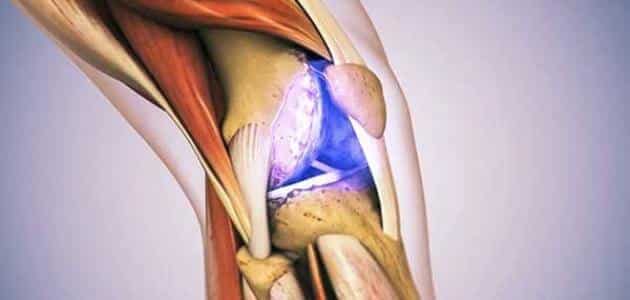 ما هو علاج غضروف الركبة