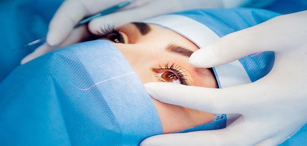 أنواع عمليات الليزك للعيون