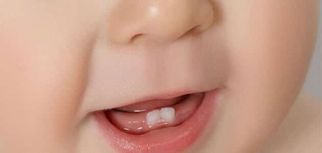 ترتيب ظهور الاسنان للاطفال