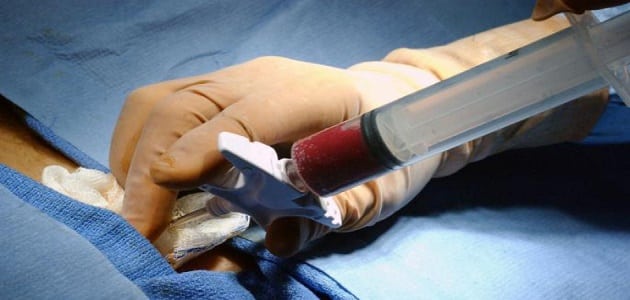نسبة نجاح عملية زرع النخاع لمرضى سرطان الدم