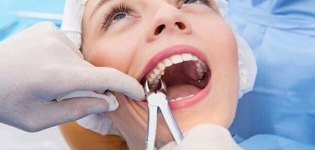 علاج ألم الأسنان للحامل في الشهر الثامن والتاسع