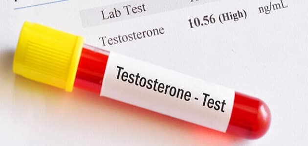 كم نسبة هرمون التستوستيرون الطبيعية عند الرجال وطرق علاج نقصه