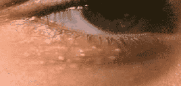 كيفية التخلص من حبوب تحت العين بنفس لون الجلد