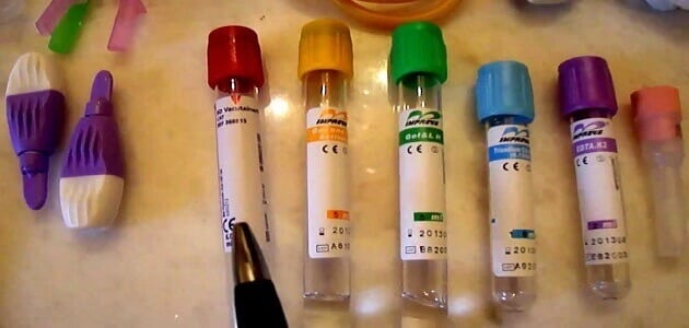 أنواع الأنابيب المستخدمة في التحاليل الطبية