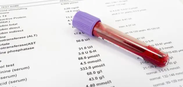 اختصارات تحليل الدم ومعانيها بالتفصيل