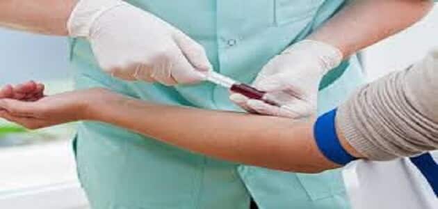 اعراض التهاب الدم الفيروسي عند الاطفال