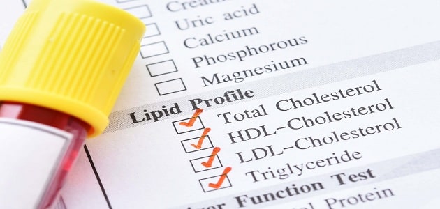تحليل Lipid Profile الدهون في الدم