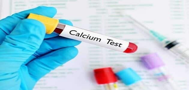 تحليل الكالسيوم .. طريقة الفحص وقراءة النتائج