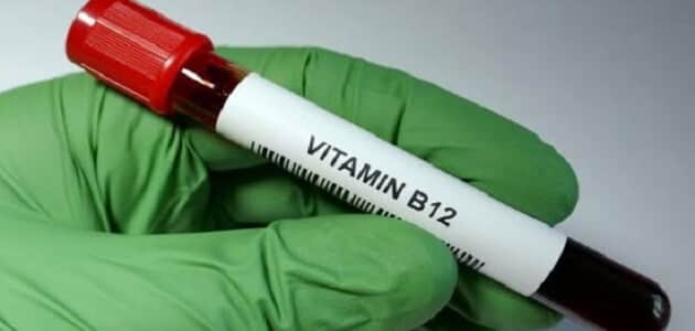 سعر تحليل فيتامين ب12 في مصر
