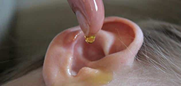 طرق علاج فطريات خلف الأذن عند الأطفال