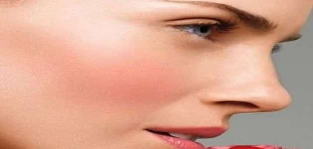 طرق علاج وردية الوجه طبيعيا بالطب البديل