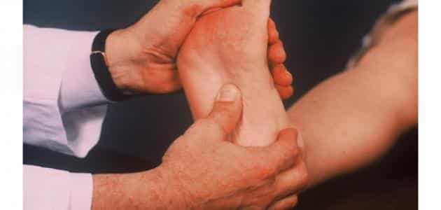 علاج ألم باطن القدم عند الأصابع