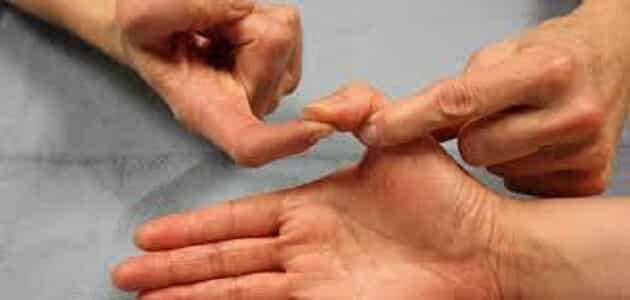 علاج التهاب اعصاب الاصابع