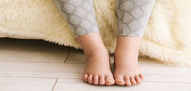 علاج جلطات الساق بعد الولادة القيصرية