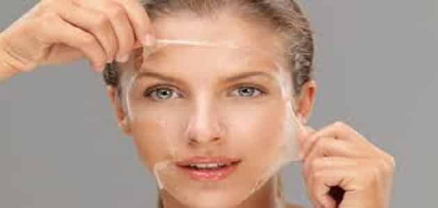 علاج وردية الوجه بالليزر والتقشير الكيميائي