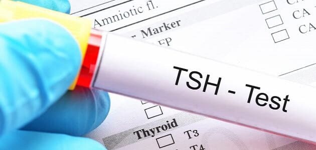 قراءة تحليل الغدة الدرقية tsh الطبيعي أو المرتفع أو المنخفض