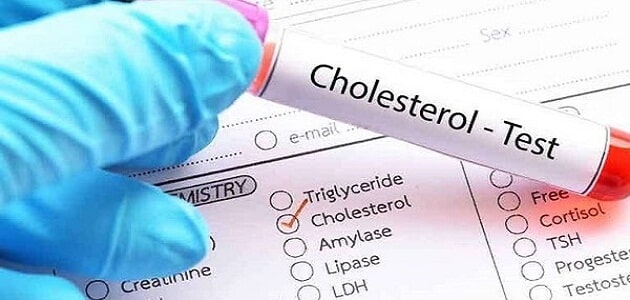 ما هو معدل الكوليسترول الطبيعي للانسان؟