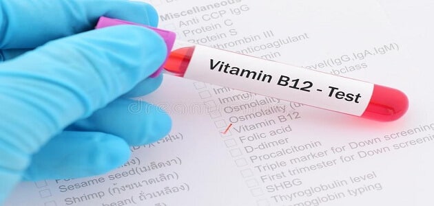 نسبة فيتامين B12 الطبيعي