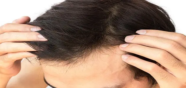 ما هي أضرار الشبكية الفرنسية لزراعة الشعر