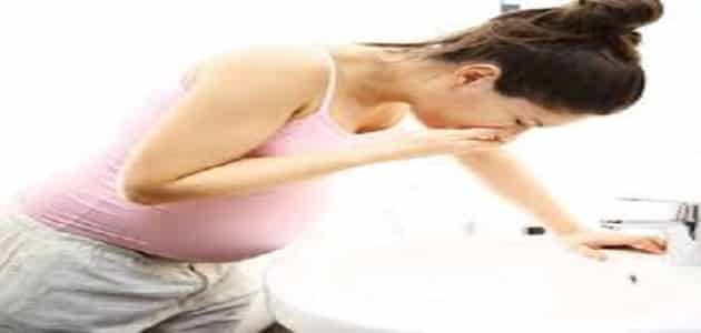 أعراض الارتداد المريئي عند الحامل