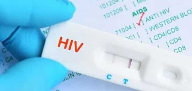 ما هو تحليل HIV نقص المناعة البشرية