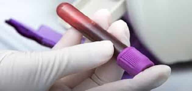 ما هو تحليل تعفن الدم