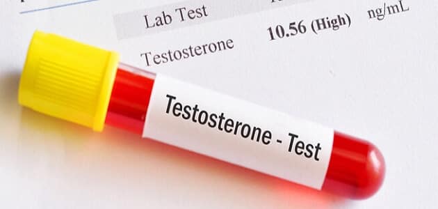 نسبة هرمون التستوستيرون الطبيعية عند الرجل nmol/l