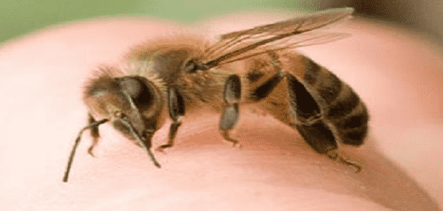 طرق علاج حساسية لسع النحل