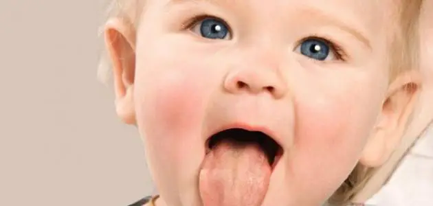 علاج بثور الفم عند الاطفال