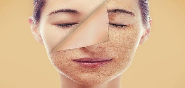 علاج تصبغات الوجه بالكريمات